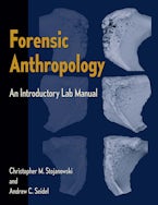Forensic Anthropology